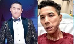 Ca sĩ Kasim Hoàng Vũ đã qua đời tại Mỹ